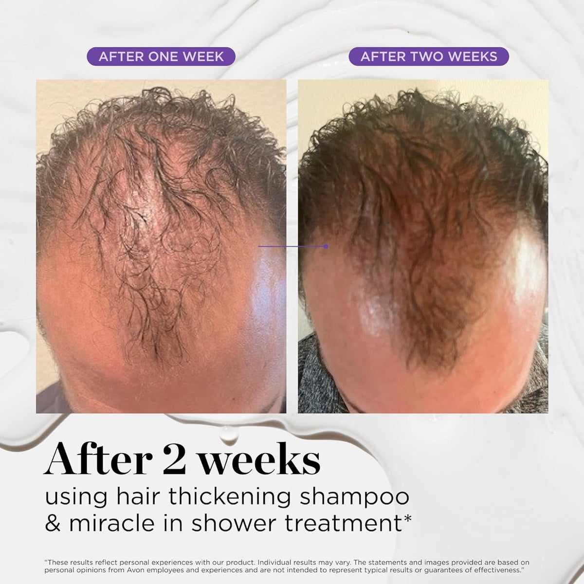 Dr.Groot Scalp Revitalizing Solution Miracle in Shower Treatment