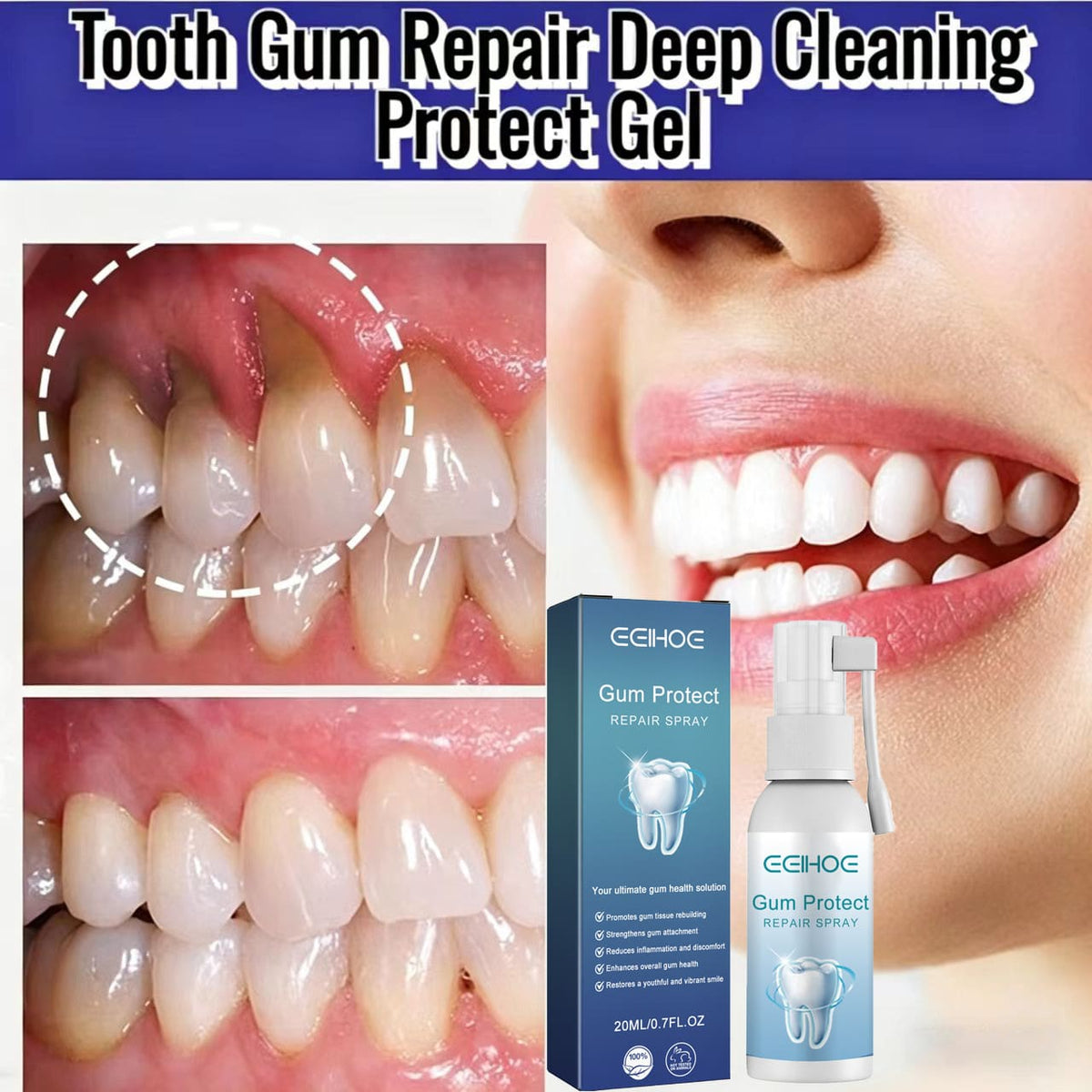 Gum Repair Spray- Relieves Swollen And Painful Gums Caused By Heat, Whitens Teeth, And Provides Oral Hygiene Care Spray