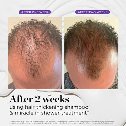Dr.Groot Scalp Revitalizing Solution Miracle in Shower Treatment