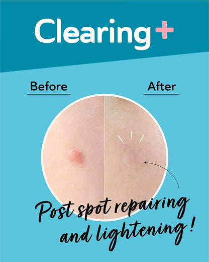 Dermaangel Ultra Invisible Dark Spot Patches Lightening