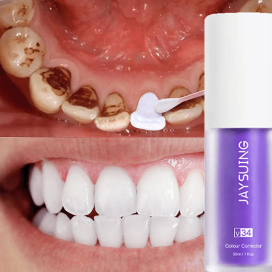 JAYSUING Teeth Whitening Kit For Radiant Smile Deeply Long Lasting Brightness Enhanced Elasticity Radiant Smile To Boost Vitality Deep Cleaning And Stain Removal Eliminates Bad Breath,Suitable For Sen