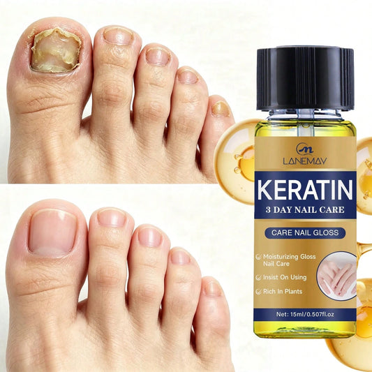 Keratin Nail Oil, Natural Plant Formula, Enhances Nail Surface Gloss, Repairs Weak And Damaged Nails, Suitable For Hands And Feet, 15ml