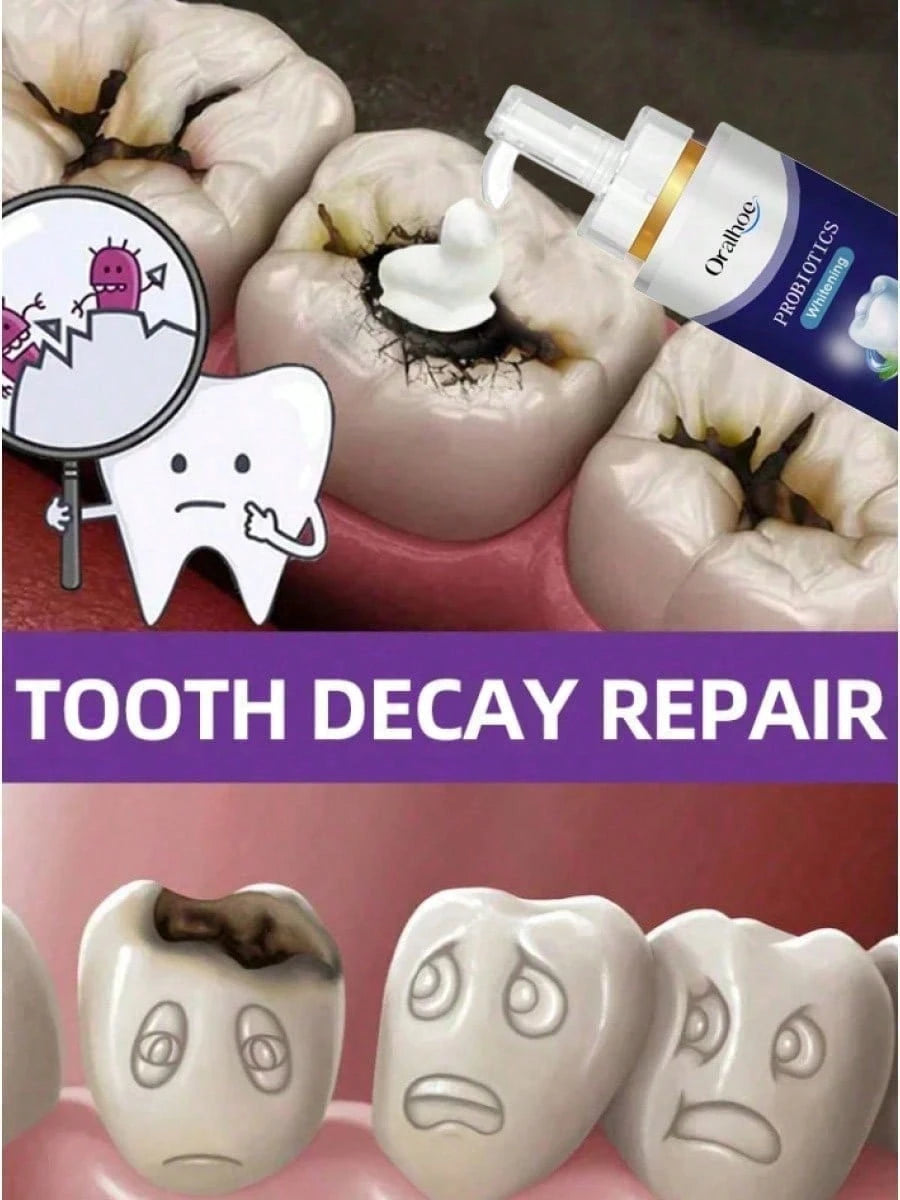Teeth Cleaning Toothpaste Removes Tooth Stains Teeth Whitening Tooth Decay Repair Calculus Plaque Periodontitis Remove Cavities