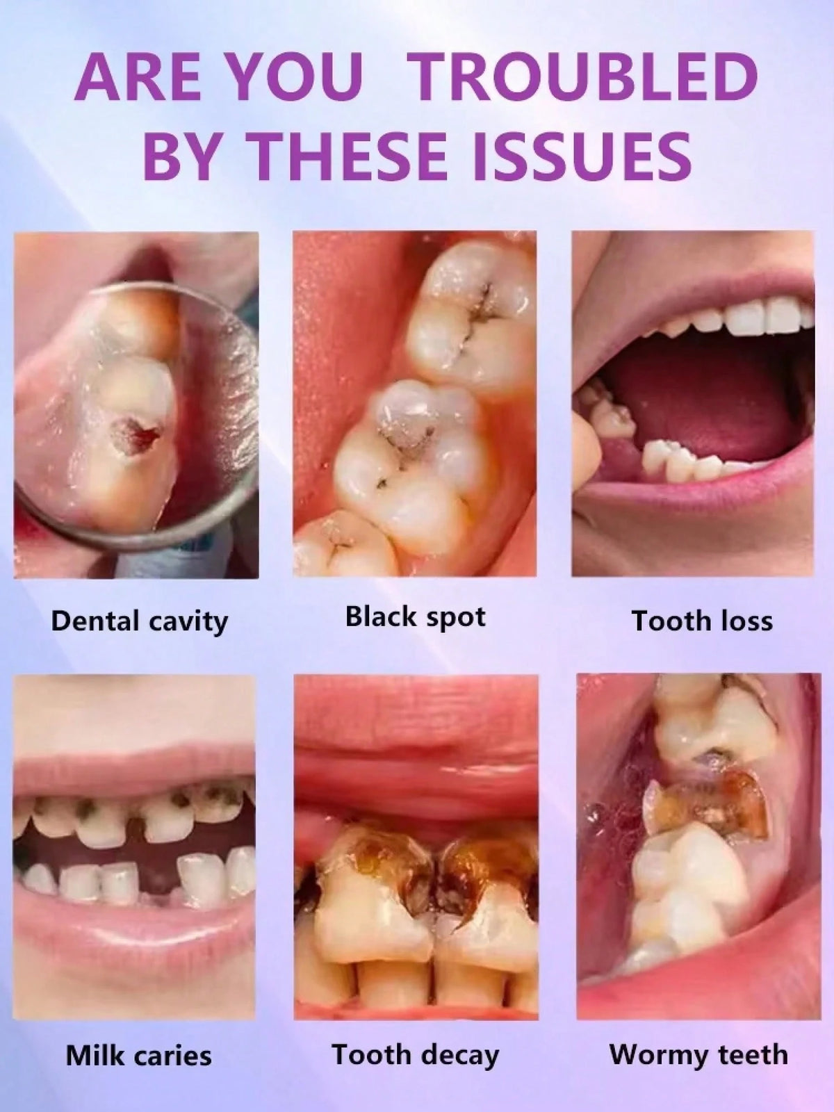 Teeth Cleaning Toothpaste Removes Tooth Stains Teeth Whitening Tooth Decay Repair Calculus Plaque Periodontitis Remove Cavities