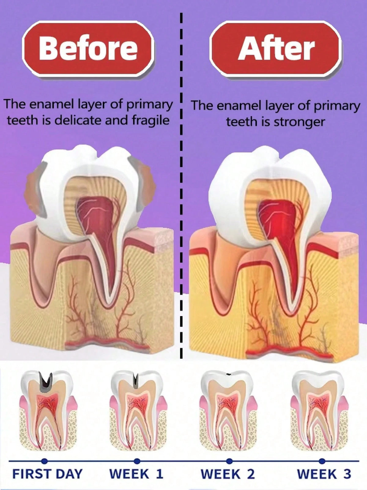 Teeth Cleaning Toothpaste Removes Tooth Stains Teeth Whitening Tooth Decay Repair Calculus Plaque Periodontitis Remove Cavities