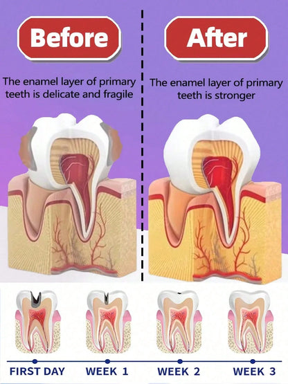 Teeth Cleaning Toothpaste Removes Tooth Stains Teeth Whitening Tooth Decay Repair Calculus Plaque Periodontitis Remove Cavities